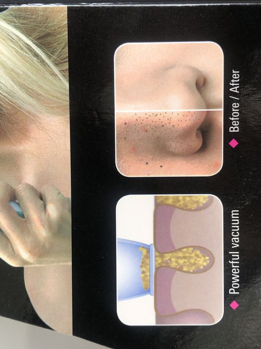 Уред за почистване на черни точки Wallneo