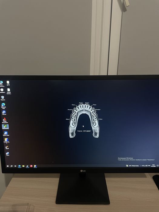 Монитор LG 24 дюйма 75 герц
