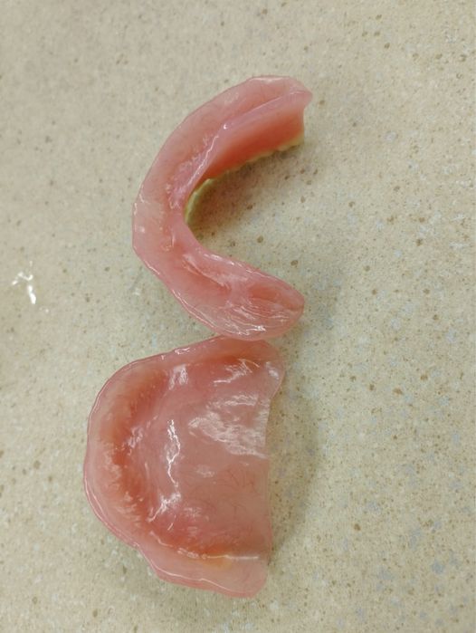 Изготовление протезов в Астане