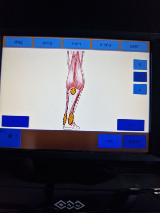 BTL Shockwave - апарат за ударно-вълнова (шокуейв) терапия SWT