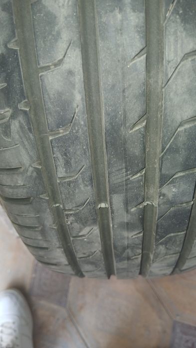 Онкс балон радной