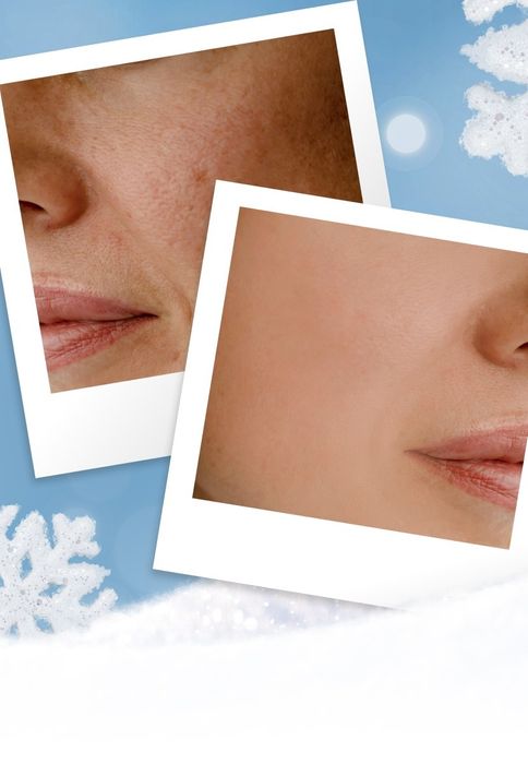 Набор Зима крема и Бальзам для губ. ПОДАРКИ НАБОР