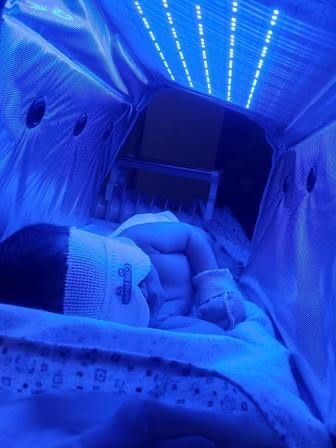 Фотолампа Fotolampa Фотолампа от желтухи