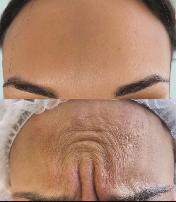 Косметолог эстет все уход и инъекционные процедуры