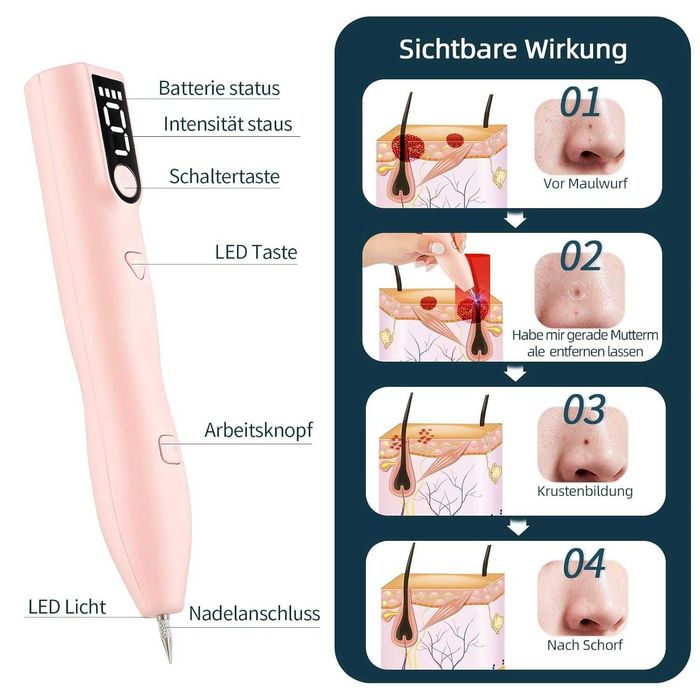 ForeverLily Премахване на белези, татуировки, бенки, петна с 9 режима