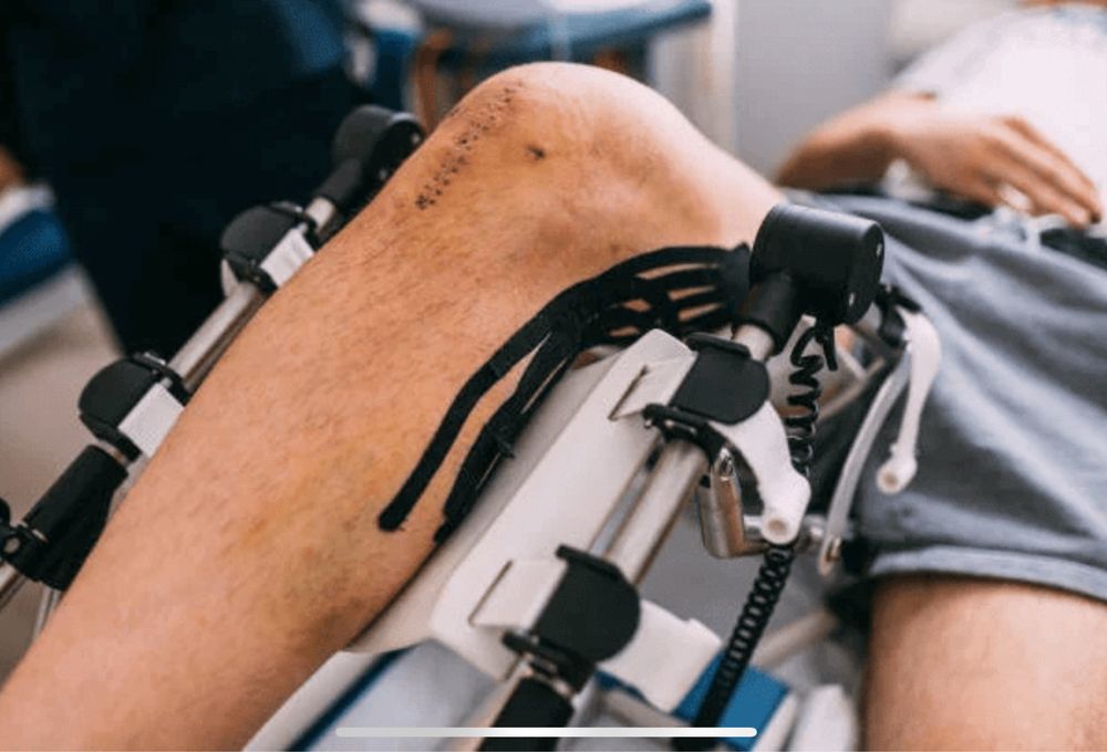 Inchiriez artromot kinetec cpm non-stop 350 / sapt