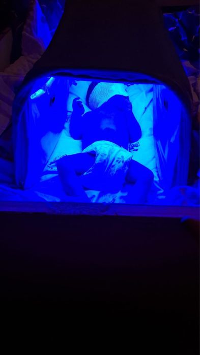 Фотолампы от желтушки Продажа