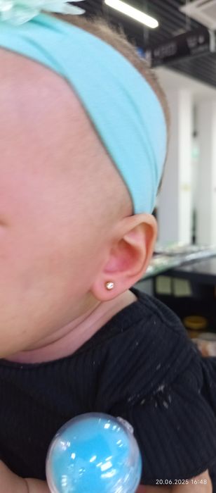 Og'riqsiz Quloq Burun teshamiz