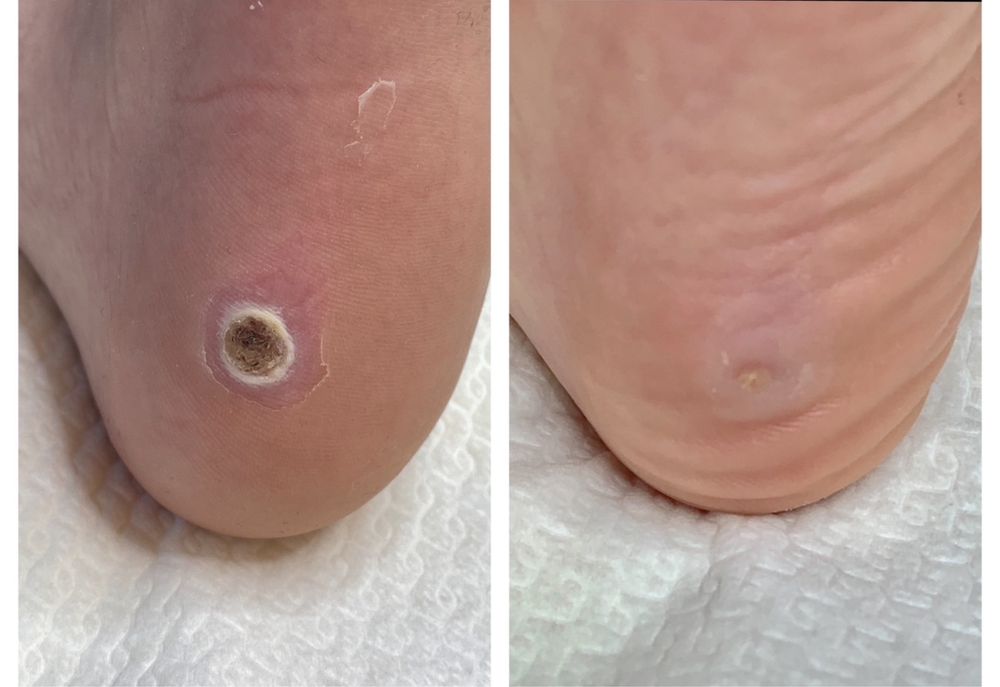 Pedichiură complexă