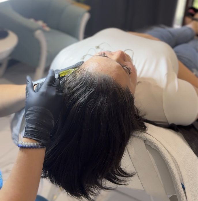 Мезотерапия для роста волос | Выпадение | Тонкие волосы