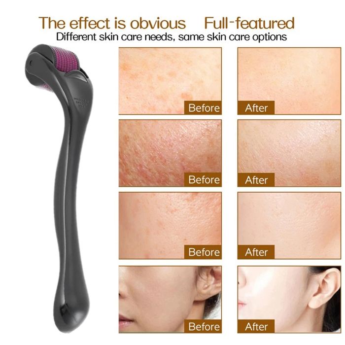 Мезороллер для тела