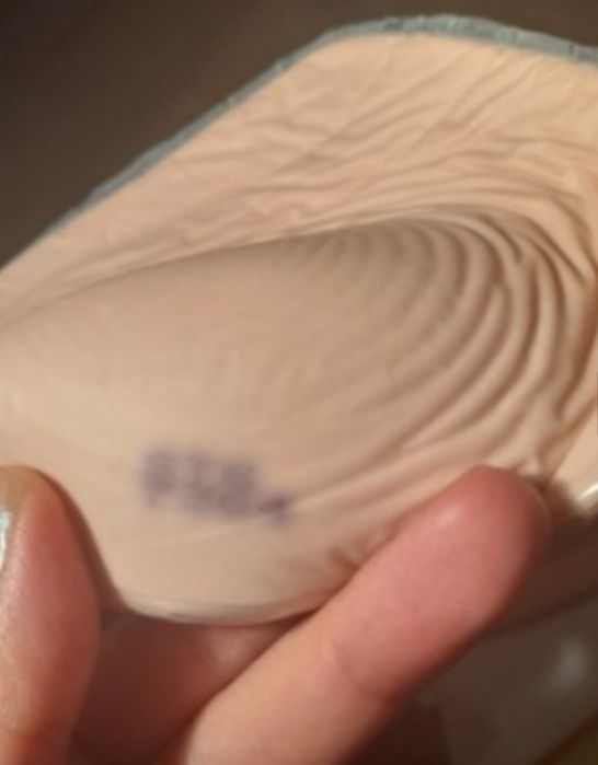 Първична гръдна епитеза