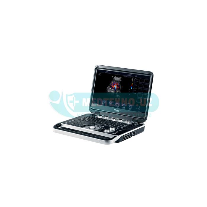 Портативный УЗИ аппарат высокого класса Finus 50