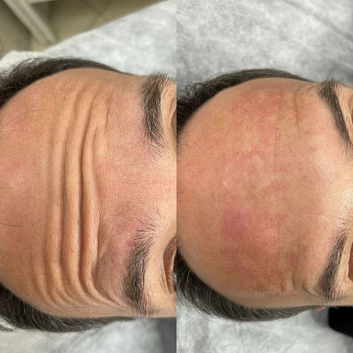 Cosmetolga chistka piling Erkeylar va ayollar uchun