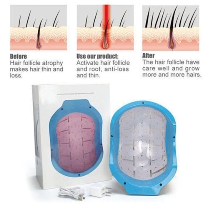 Casca laser regenerare/crestere par, cu 80 diode pentru femei/barbat