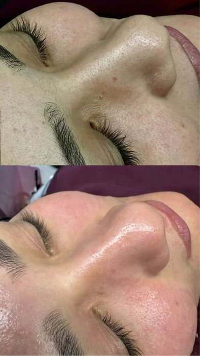 Услуги косметолога эстетиста! Все виды процедур