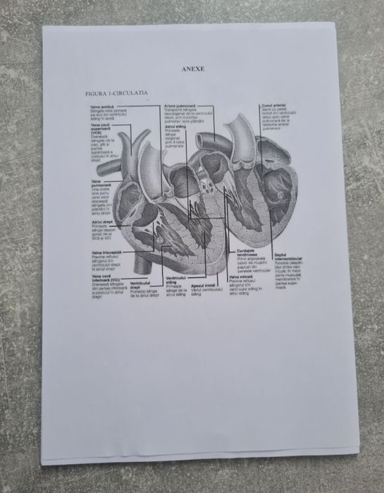 Proiect Infarct Miocardic Acut