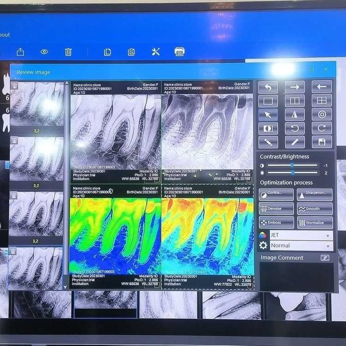 Комплект -  рентген XpectVision XVbeam2000 + визиограф XVS2530