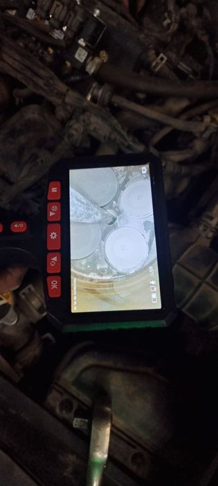 Услуги эндаскоп на выезд