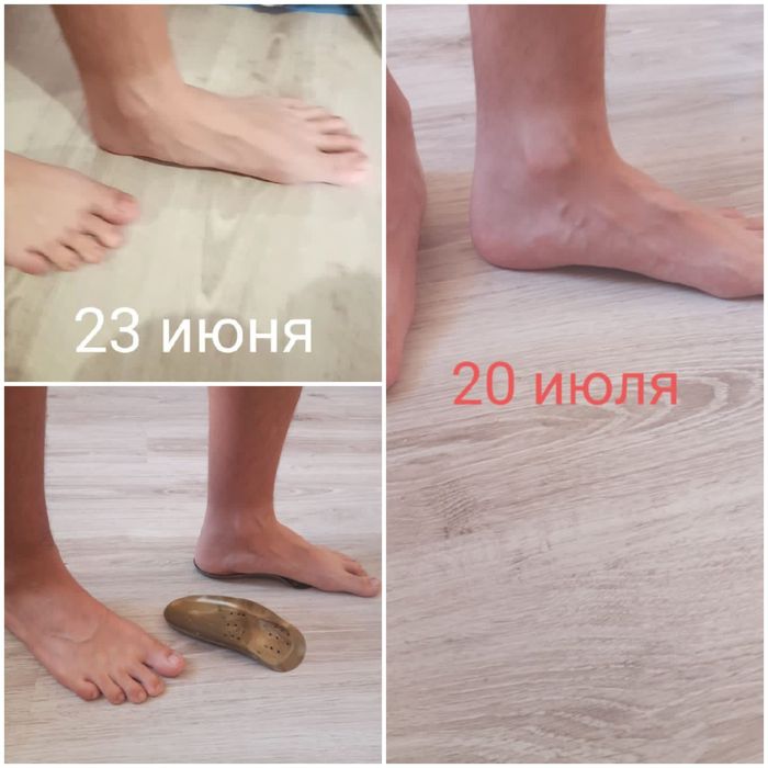 Ортопедические стельки