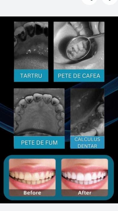 Cadouri,oferta,aparat dentar,detartraj,NOU
