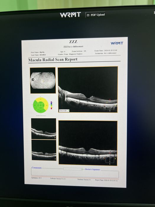 Офтальмологический OCT-аппарат WRMT C800