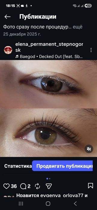 Перманент,лазерное удаление