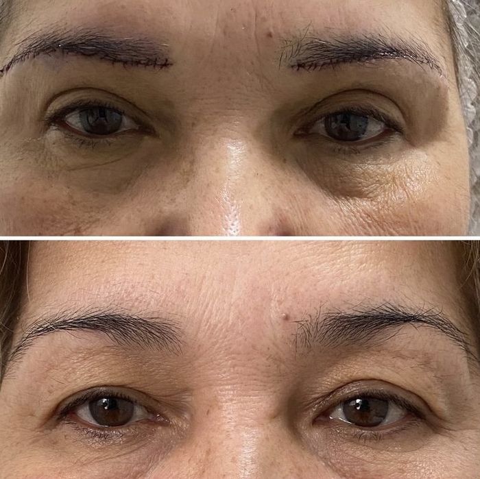 Броулифтинг со скидкой