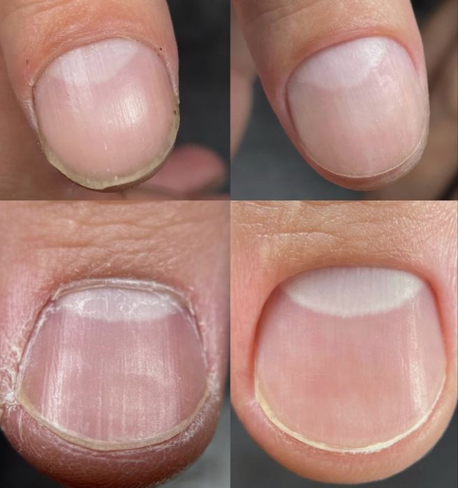 Мужской педикюр от А до Я