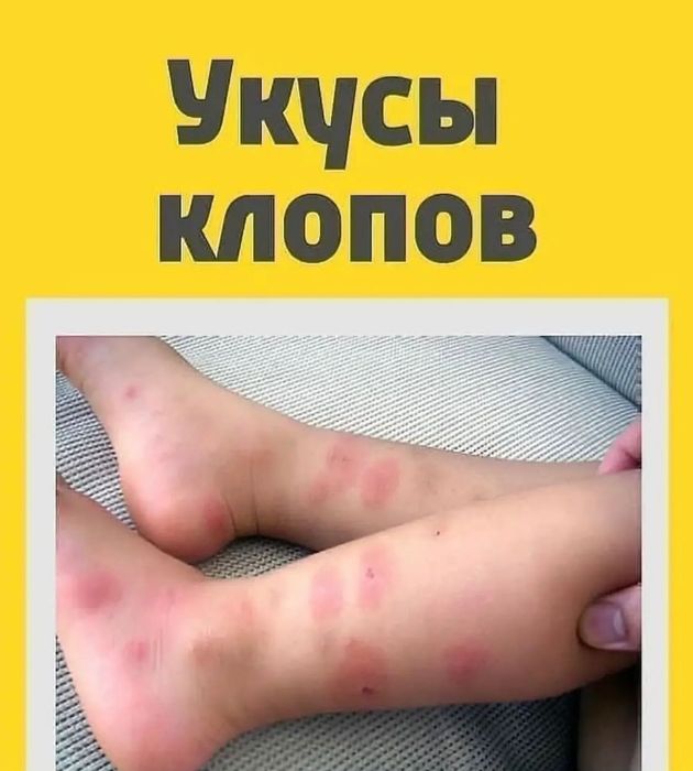 Дезинфекция | Dezinfeksiya xizmati | Dizinfeksiya | Dizenfeksiya |