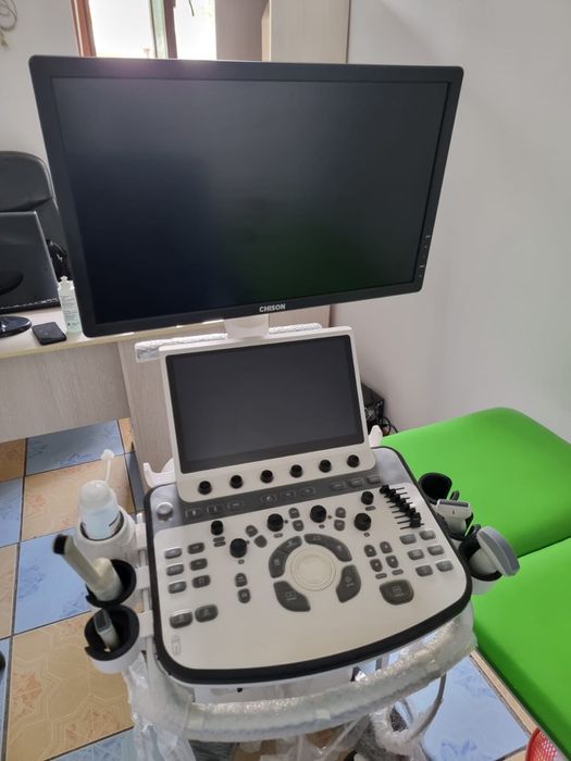 Узи аппарат Chison