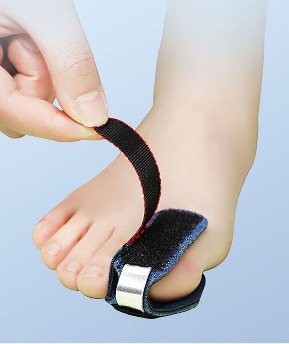 Фиксотор ортез для пальцев ног корсет вместо гипса от перелома