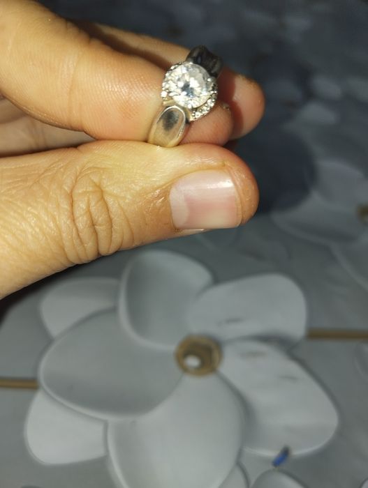 Kumush uzuk salga yoki ichki kasallilar sabab qoraymedi chiroyli