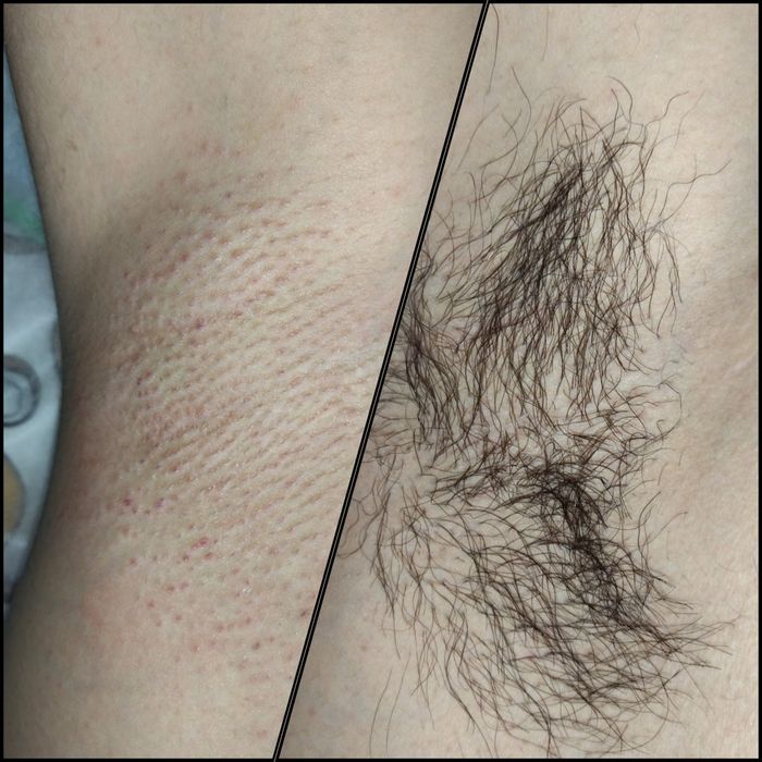 Шугаринг Усть-Каменогорск