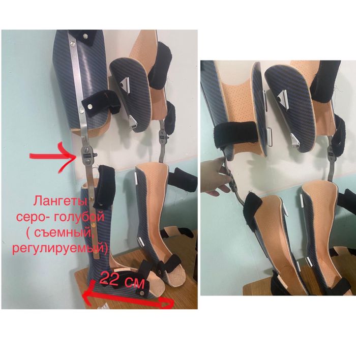 ортопедические лангеты (ортезы)