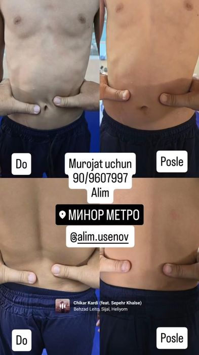 ЛФК профилактика отдышки остеохондро ,сколиоза и лордоза от 7 до 60 ле