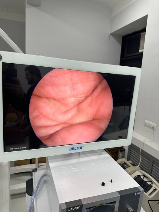 Видеоэндоскопы (видеоэндоскопические системы) от бренда Aokace