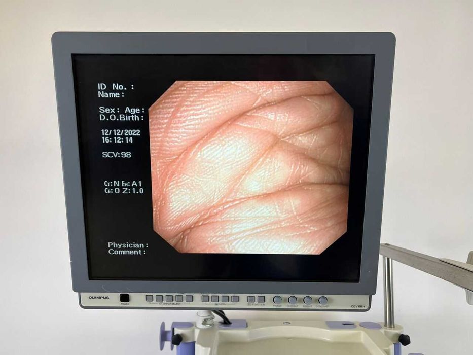 Видеогастроскоп GIF-V70 Olympus