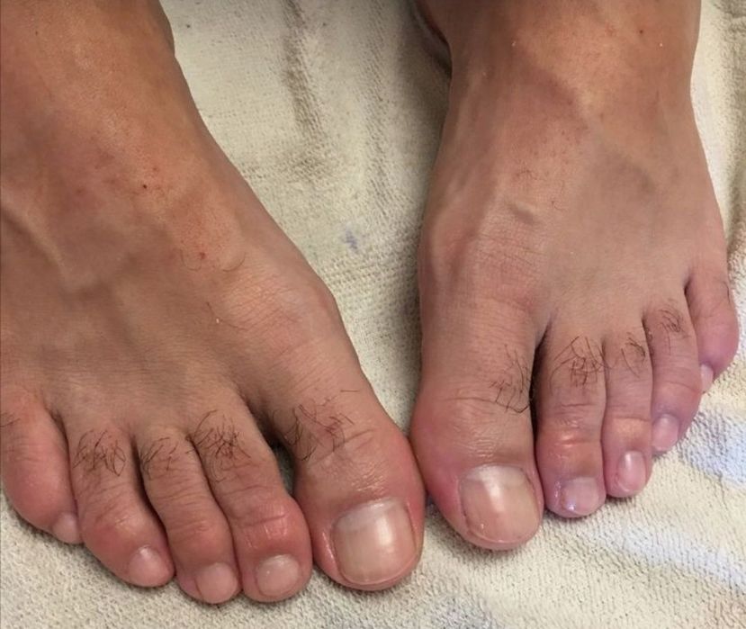 Мужской педикюр, маникюр.