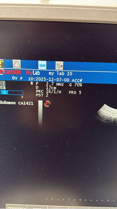 Ecograf  Esaote mylab 20