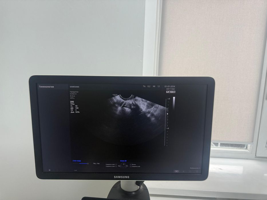 УЗИ Samsung Madison HS 40