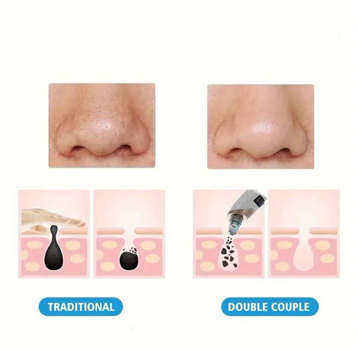 Уред за почистване на лице с вакуум