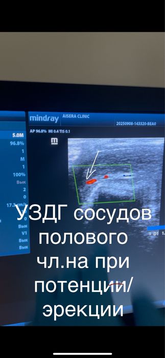 Уролог-андролог|цены доступные|лечение|операции