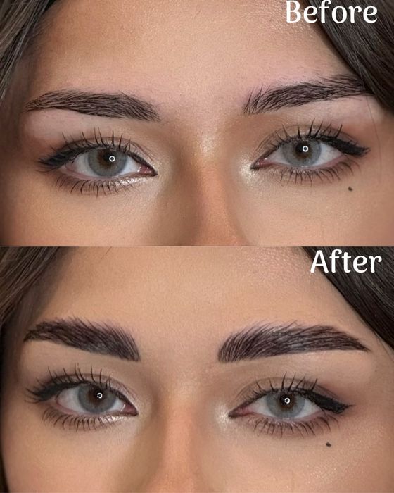 Laminare gene si sprancene