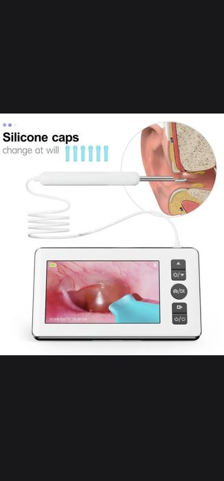 Отоскоп для чистки ушей