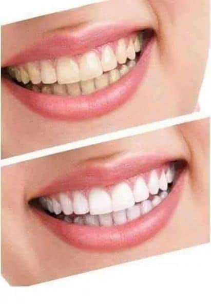 Избелваща паста за зъби Extra White Pro