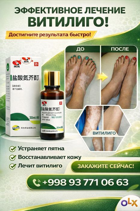 Лосьон от витилиго | Восстановление пигмента кожи
