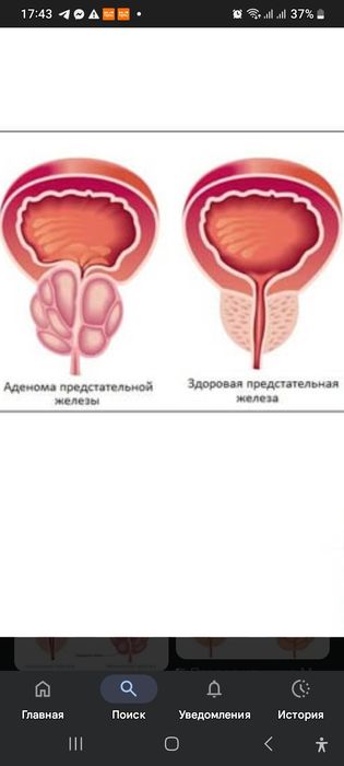 Для профилактики