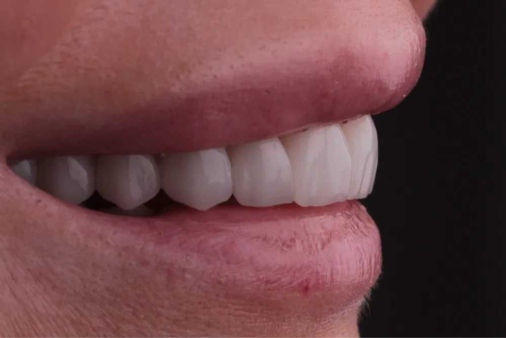 Зубного техника Cad/Cam системы в стоматологии