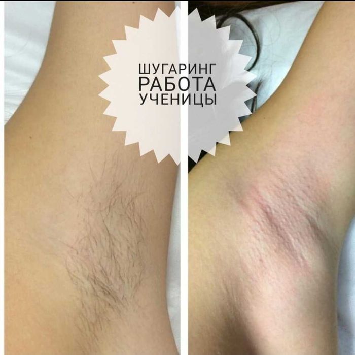 Курсы по Шугарингу " АКЦИЯ "